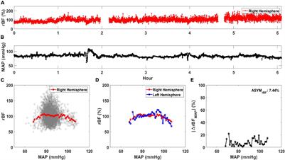 Cerebral Blood Flow Hemispheric Asymmetry in Comatose Adults Receiving Extracorporeal Membrane Oxygenation